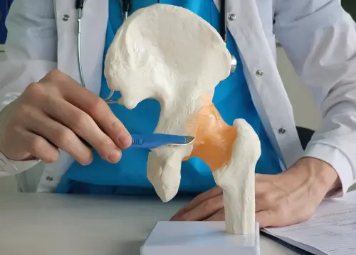 Hip Replacement Surgery